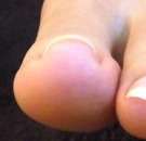 治療を受けてすぐに痛みがなくなりました。