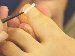 治療中、治療後共に全く痛みも無く